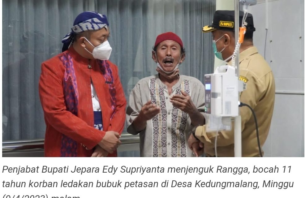 PJ Bupati Jepara Kunjungi Bocah Korban Ledakan Obat Mercon